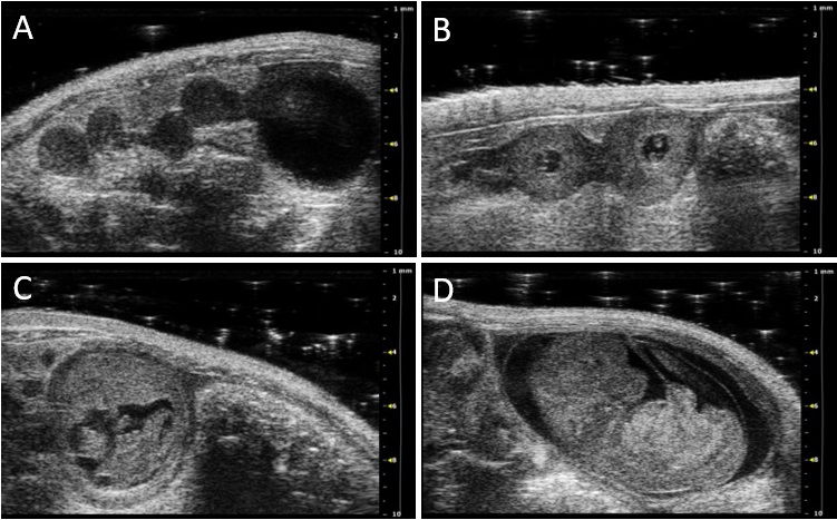 2D grey-scale ultrasound images